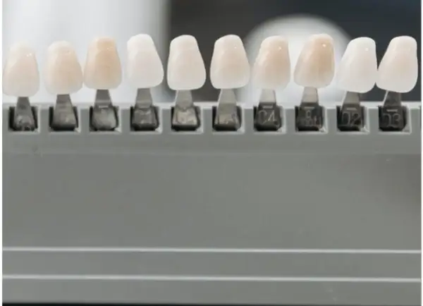 Muestras de dientes de diferentes tonos, para elegir el color perfecto y evitar la enfermedad de los dientes que se caen.